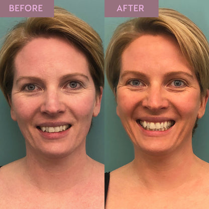 Overnight Hyaluronic Self Tan Balm 50ml - Relaxing Facial Night Tan